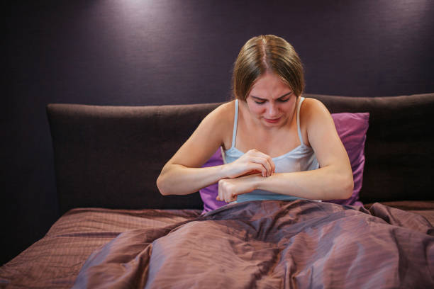 Signs of Bed Bug Bites Versus